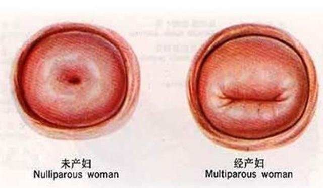 代生孩子哪里便宜(代生孩子哪里便宜?最划算的选择在哪里?)